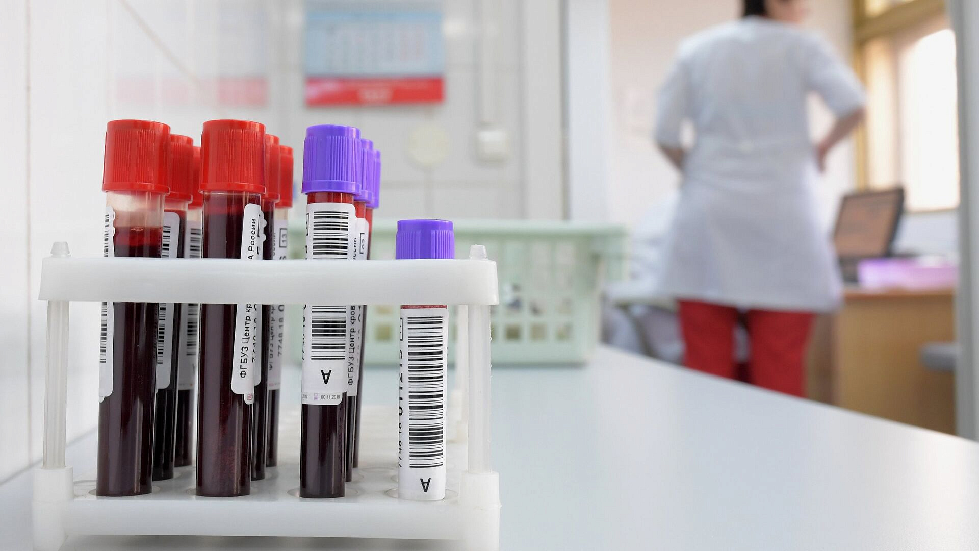 Более 730 тысяч жителей Подмосковья проверились на ВИЧ с января