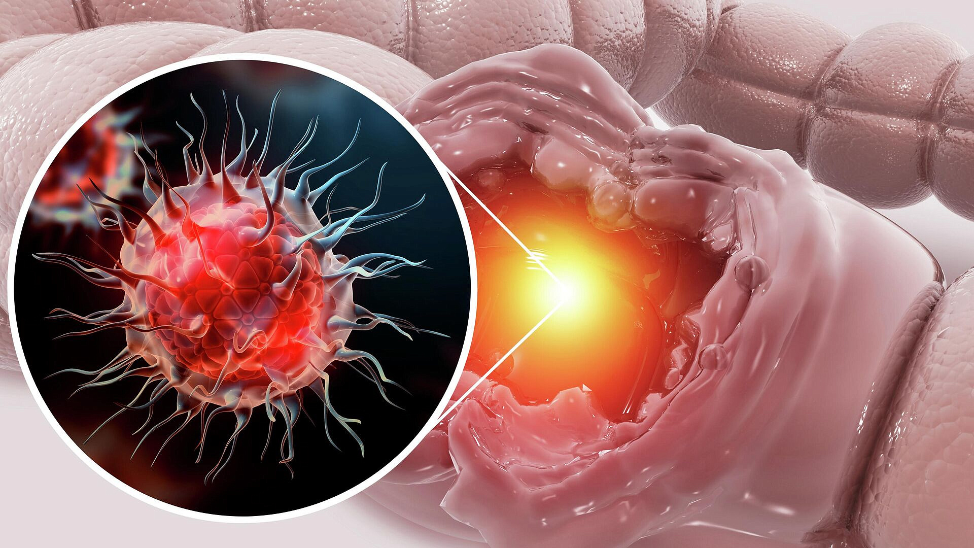 ������ ����� ���� � ���������� ����� ������� ������