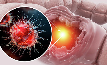 Ученые нашли путь к подавлению роста раковых клеток