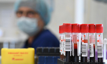 В России разработали новую методику, которая поможет в борьбе с тромбозом