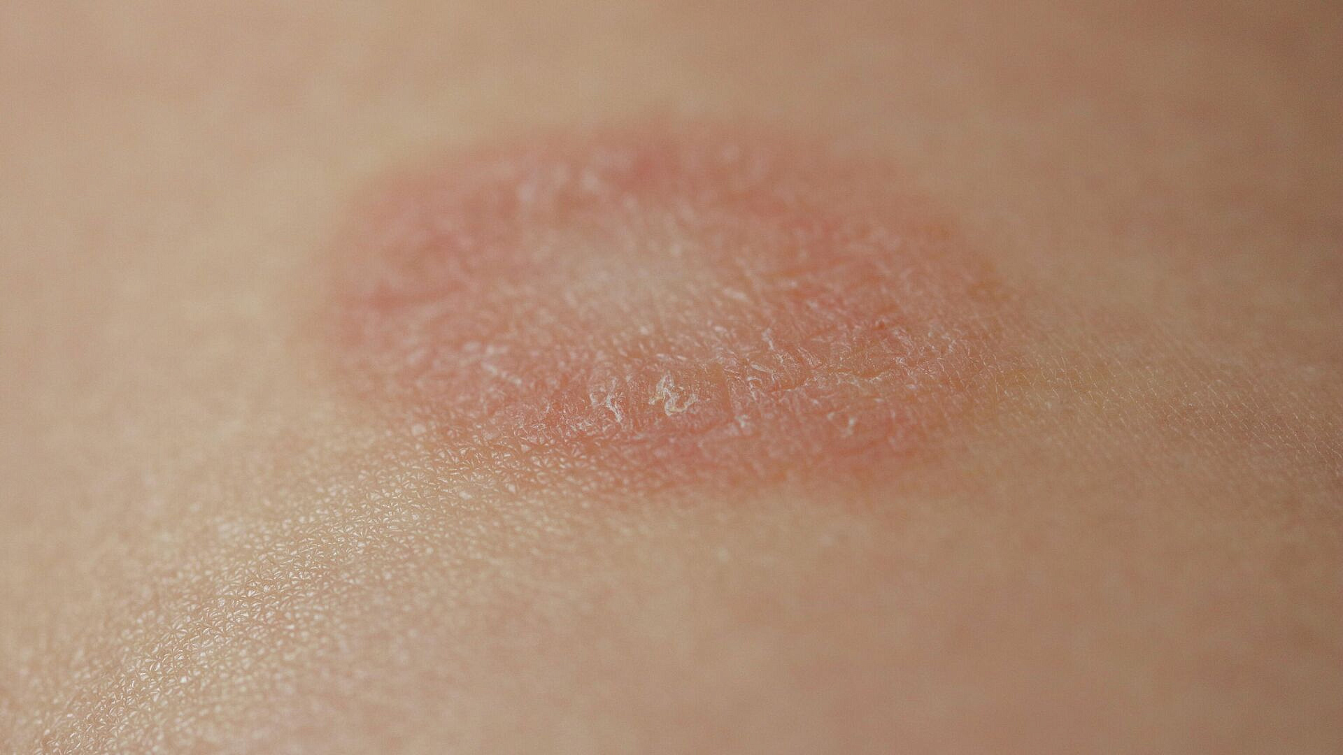 ��������������� ���������������� �������� � ������� ������ � ��������