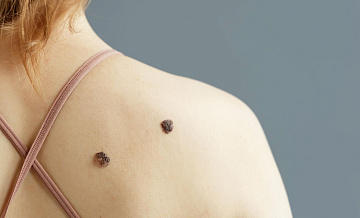 Врачи назвали популярную привычку, серьезно повышающую риск развития рака