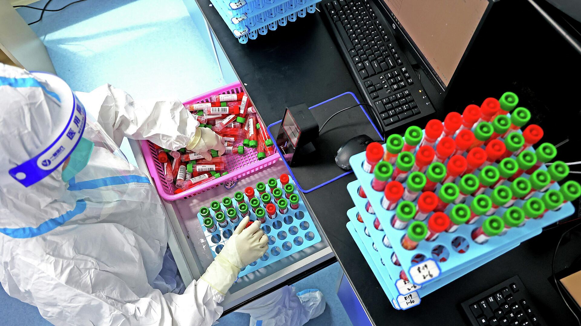 Китайские ученые нашли способ лечения болезни Альцгеймера, пишут СМИ