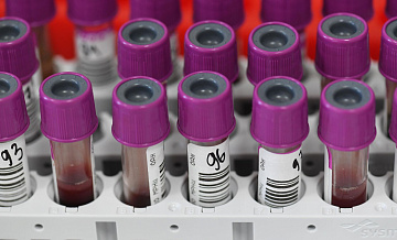 Почти 800 человек проверились на онкозаболевания в Подмосковье