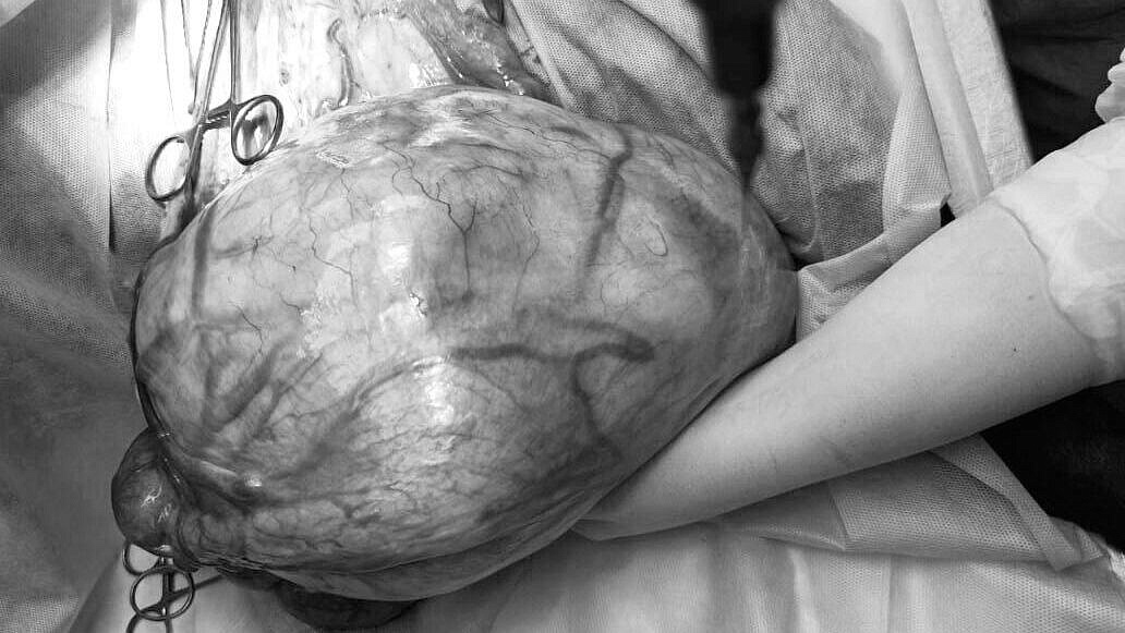 ���������� ���������� ������� � ������ �������� �������