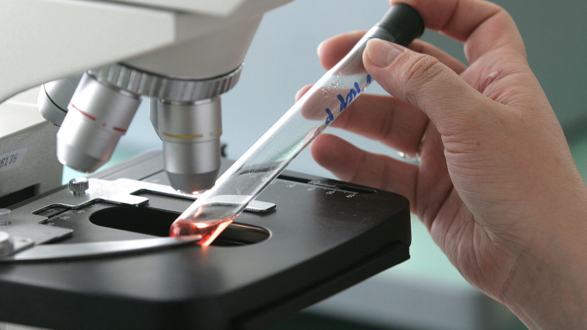 СМИ: установлено, что вирус рыб вызывает серьезные болезни глаз у людей