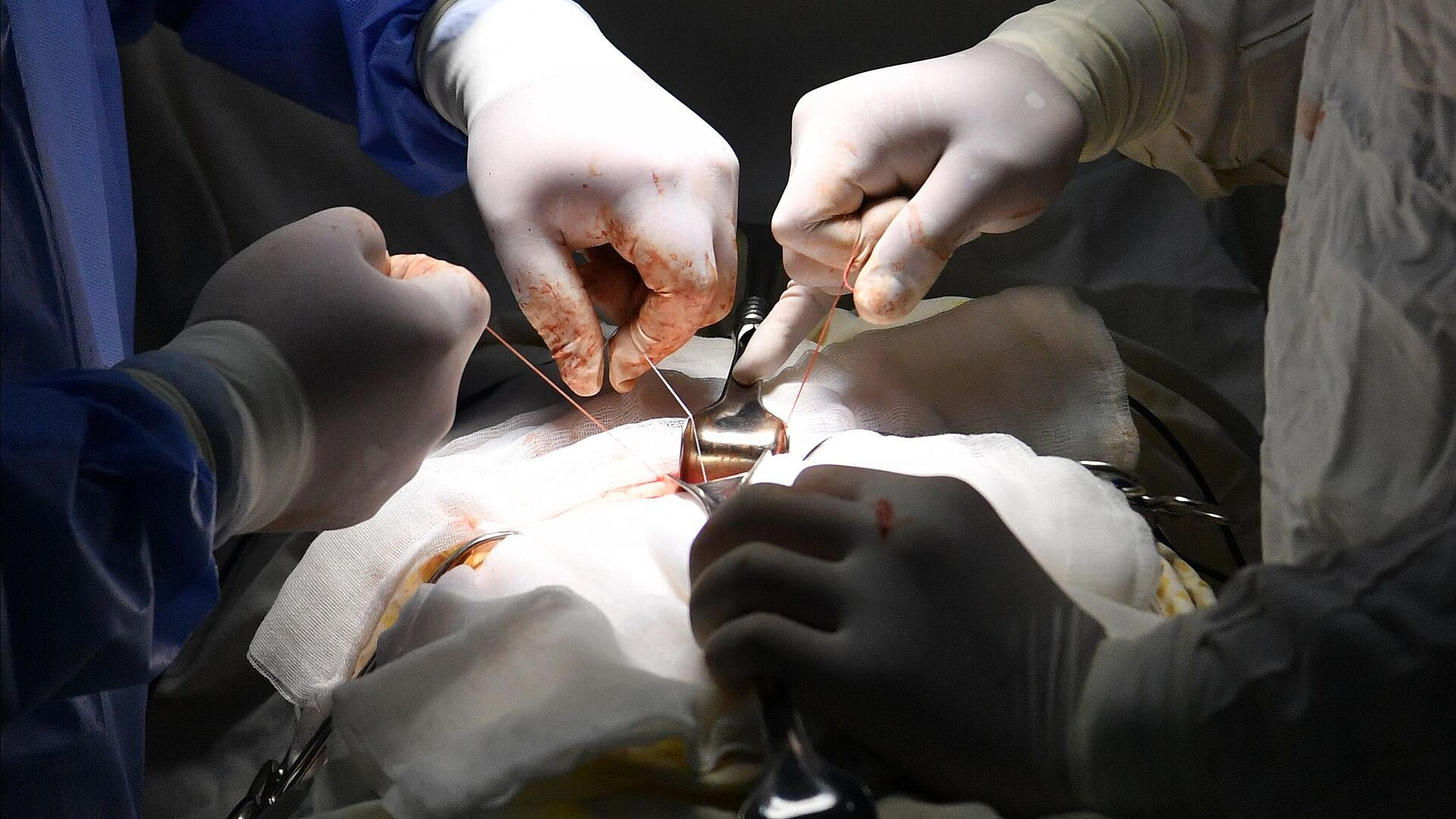 В Египте врачи провели операцию на сердце российскому туристу