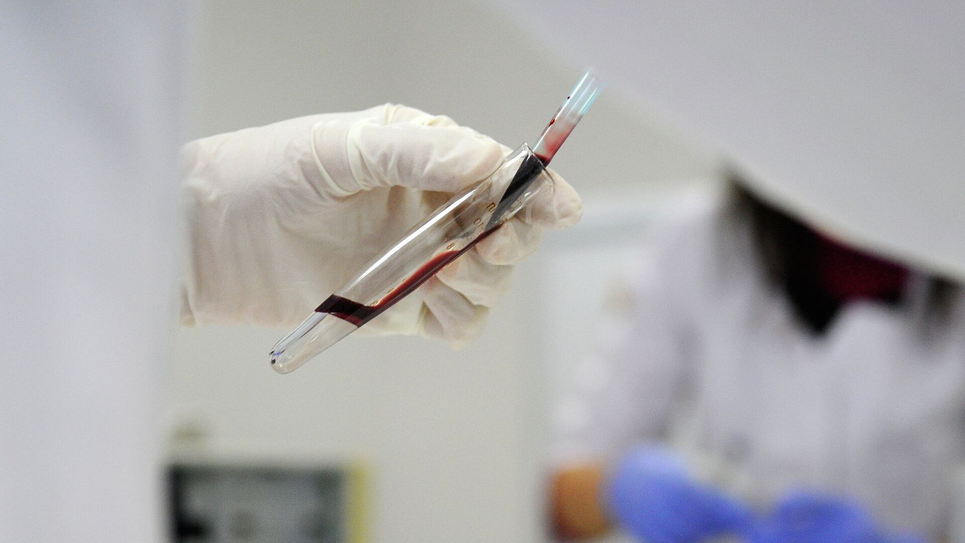 В МГУ рассказали, как вирус оспы обезьян передается от животных человеку