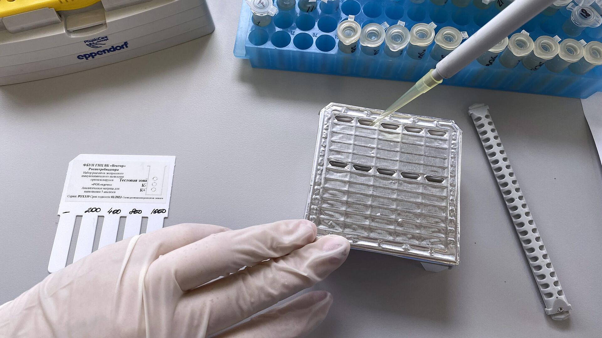 В Домодедовскую больницу госпитализировали двоих пациентов с оспой обезьян