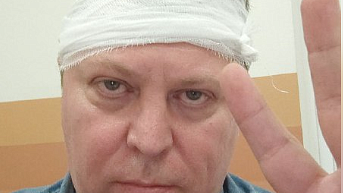 Суд получил материалы дела о покушении на депутата Матвеева