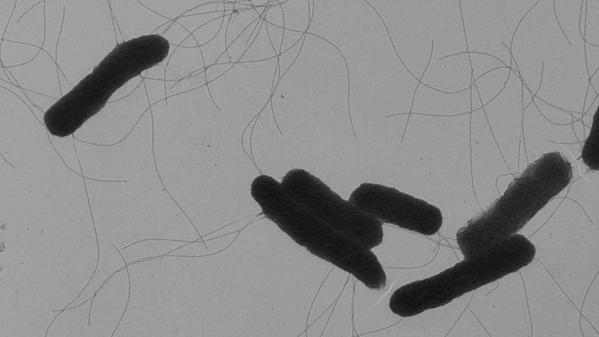В Забайкалье у 21 вахтовика подтвердили заболевание сальмонеллезом