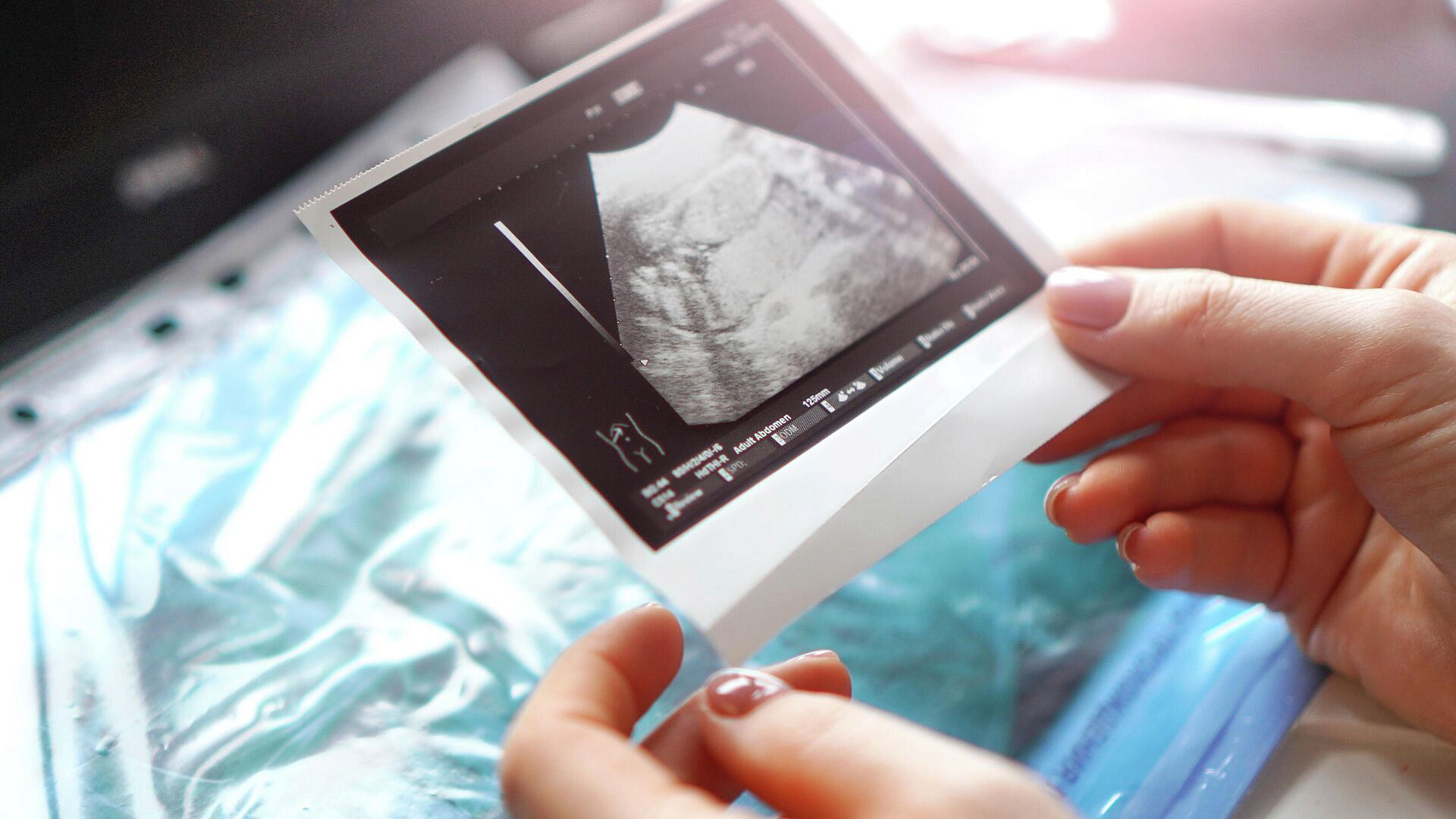 �� ������ � ������ �������� ������� ��������������� ��������