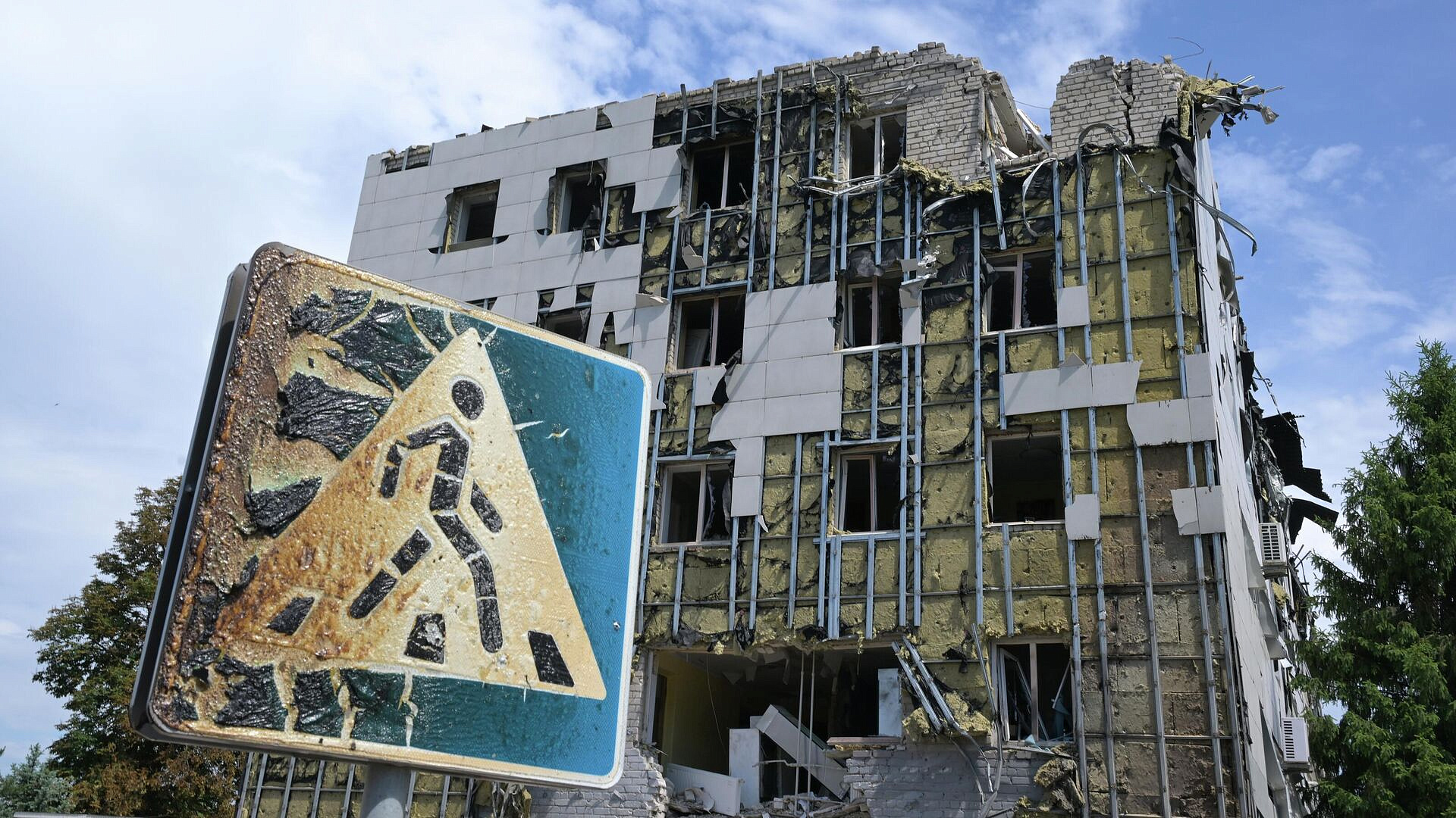 Один из пострадавших от атаки ВСУ в ЛНР остается в крайне тяжелом состоянии