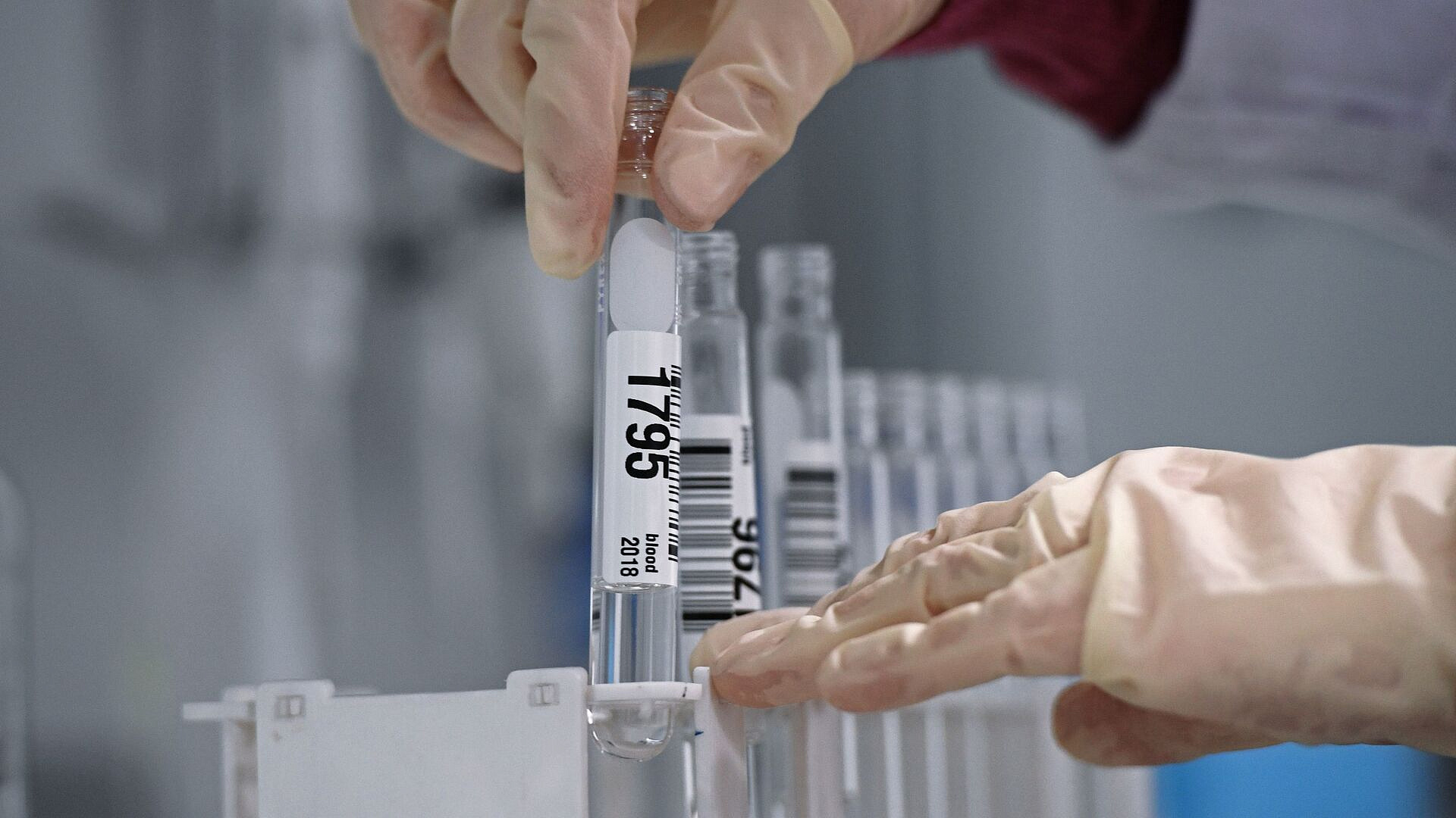 Стало известно, сколько допинг-проб было собрано на Олимпиаде в Италии