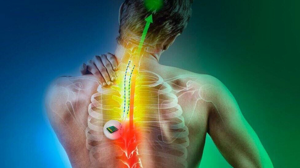 Заблокировать боль. Ученые предложили имплантаты для нервной системы