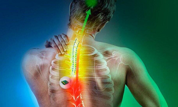 Заблокировать боль. Ученые предложили имплантаты для нервной системы