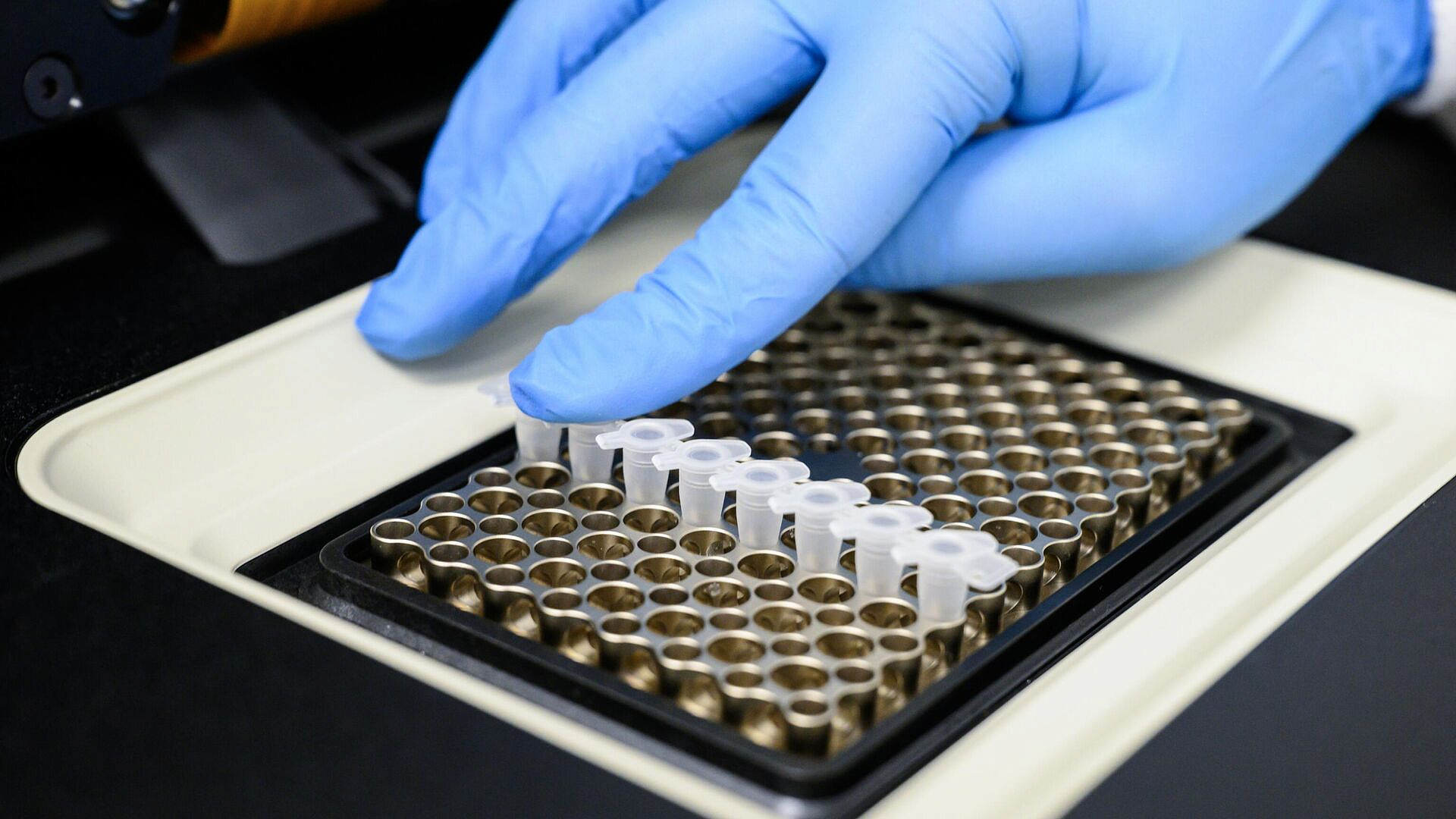 В ФМБА разработали тест-системы на особо опасные инфекции для военных